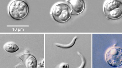 Microscopic images of Cyclospora cayetanensis parasites at different developmental stages, with a 10-micrometer scale bar.
